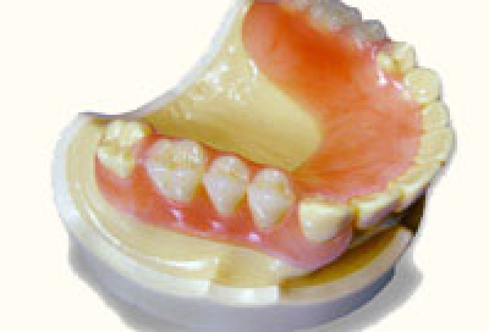 ニーズに適した、様々な入れ歯