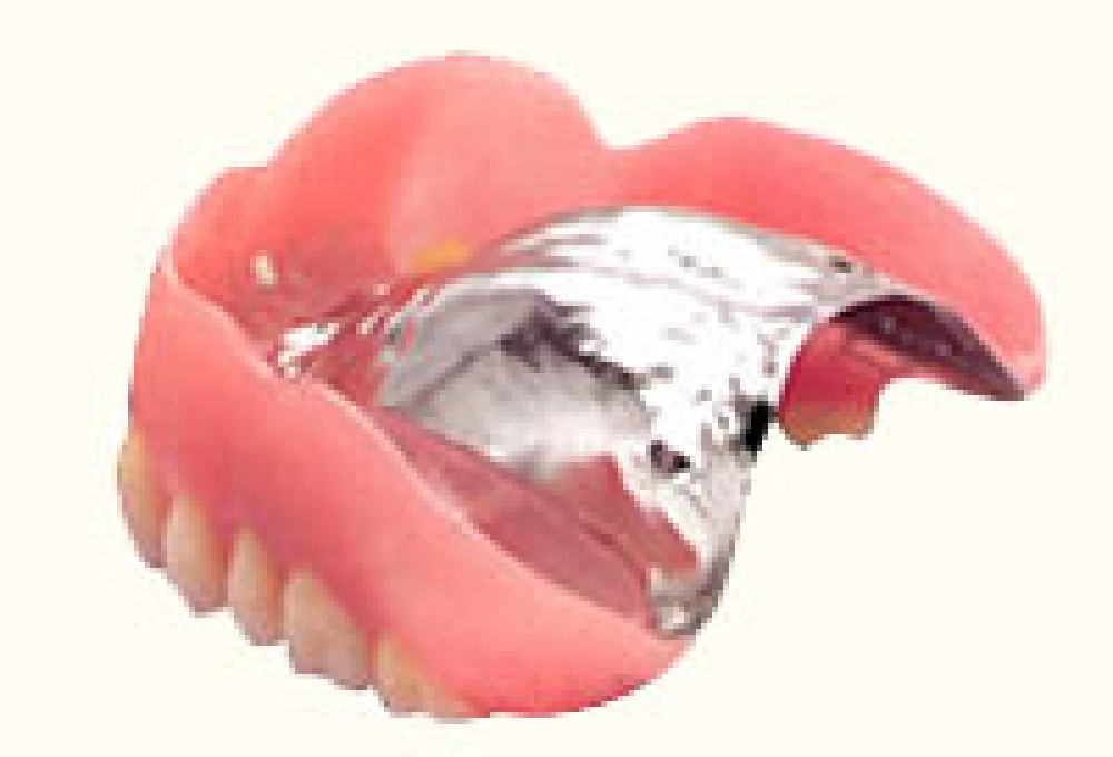 ニーズに適した、様々な入れ歯